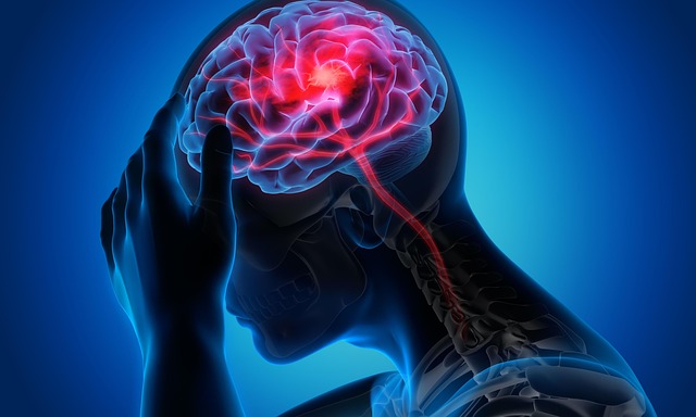 man-8225398_640 Migraine